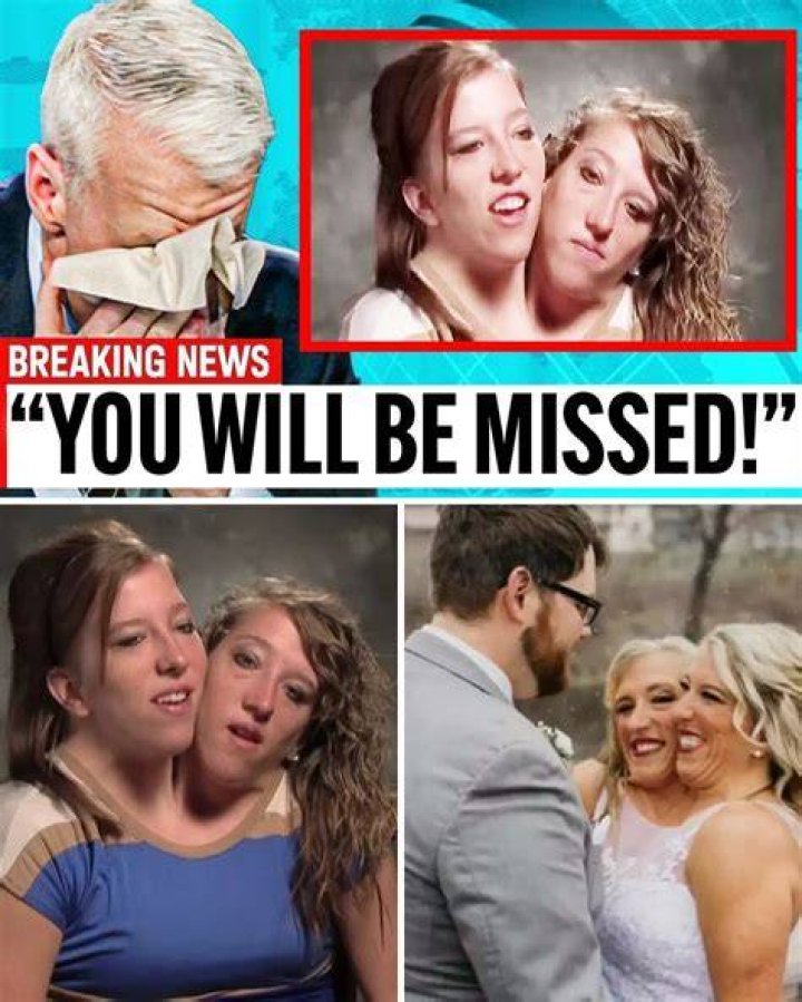 Abby And Brittany Hensel: Their Inspiring Story And Heartbreaking End
