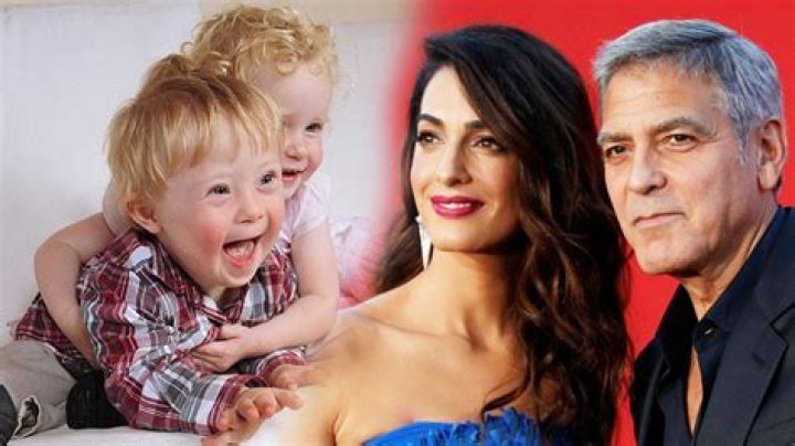 Does Clooney Have A Child With Down Syndrome? Uncovering The Truth