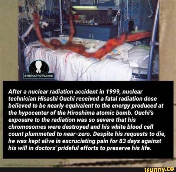 The Tragic Aftermath: Hisashi Ouchi's Radiation Legacy