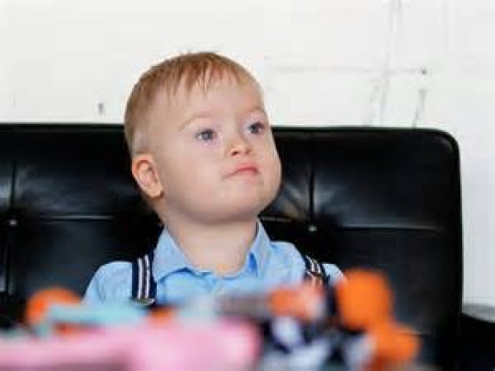 Unraveling The Mystery Of Down Syndrome