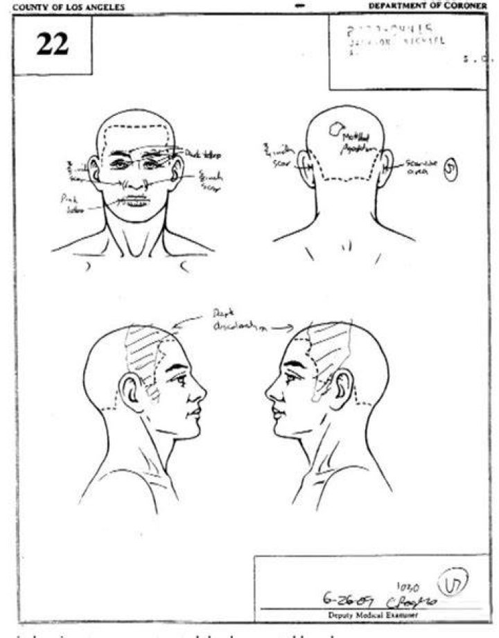 Unveiling The Enigma: Michael Jackson Autopsy Report Revealed